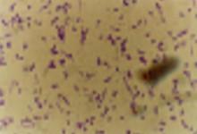 Inoculum of Phosphate solubilising bacterial (PSB) strains | ICAR ...